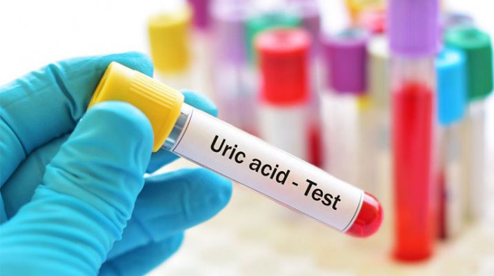 Axit uric sẽ tích tụ trong máu và làm tăng nguy cơ mắc gout